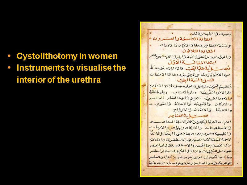 Cystolithotomy in women Instruments to visualise the      interior of